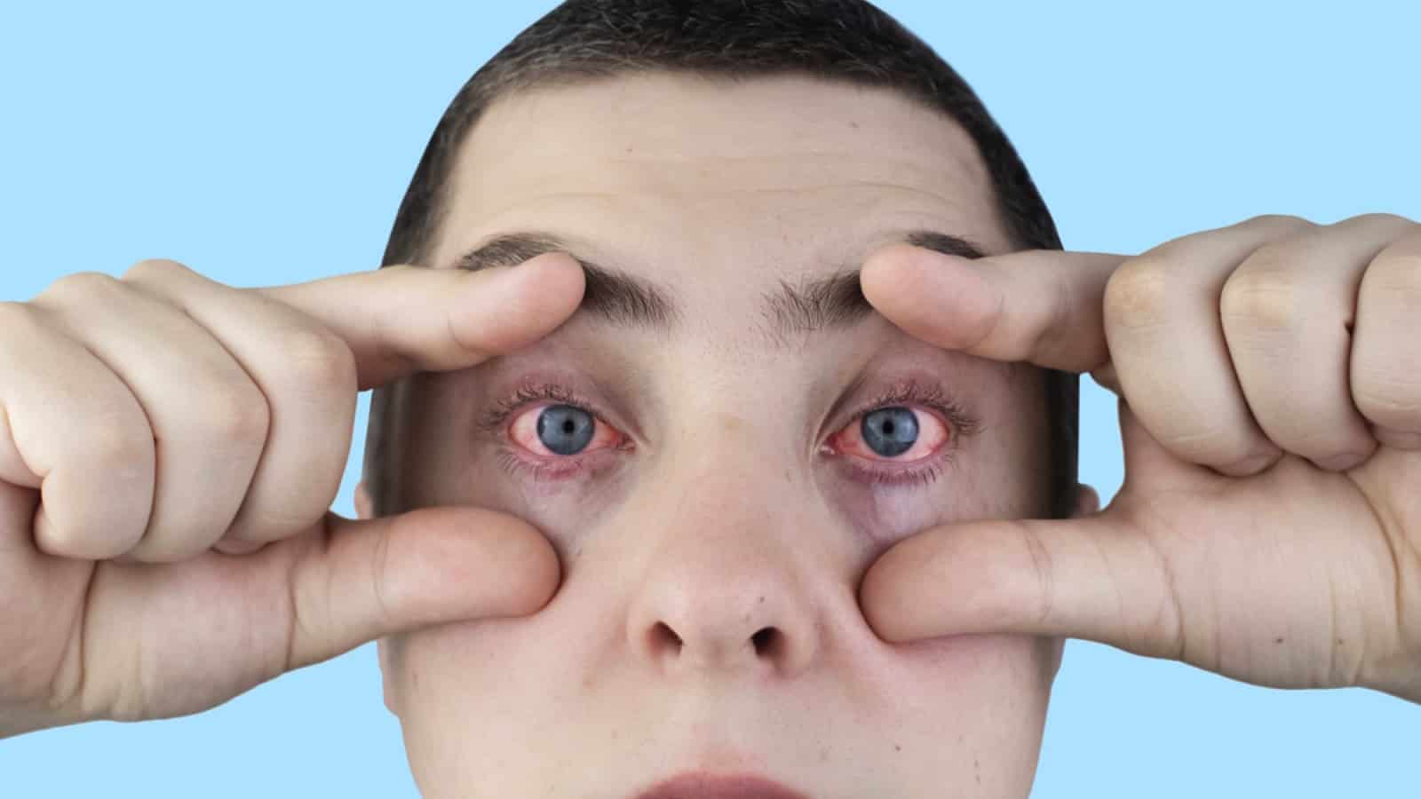 Homem com olhos vermelhos